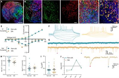 Silk scaffolding drives self-assembly of functional and mature human brain organoids